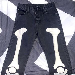 MNML skeleton jeans (I took out the middle piece because it looks better imo)